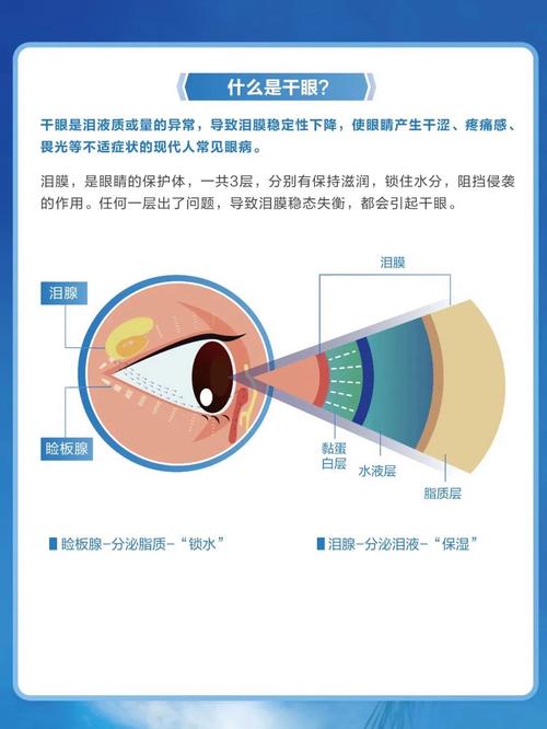 成年人干眼症预防与治疗(干眼症怎么预防和治疗方法)