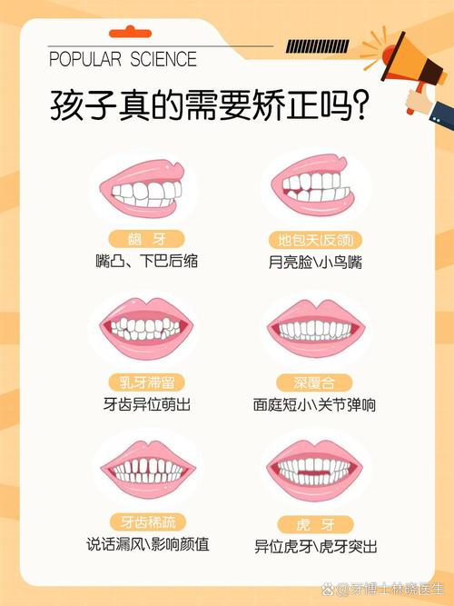 儿童口腔不良习惯纠正（儿童口腔异常）